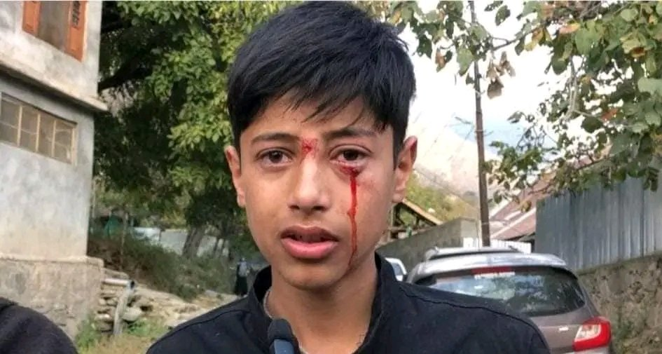 Teenager beaten by Madrasa teacher in Ganderbal for not wearing khan dress 1